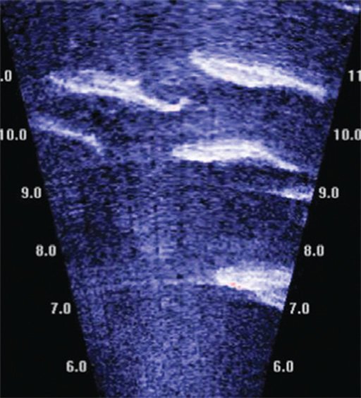 mapping-1